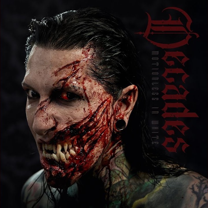MIW