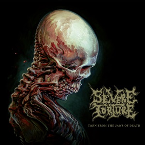 SEVERE TORTURE
